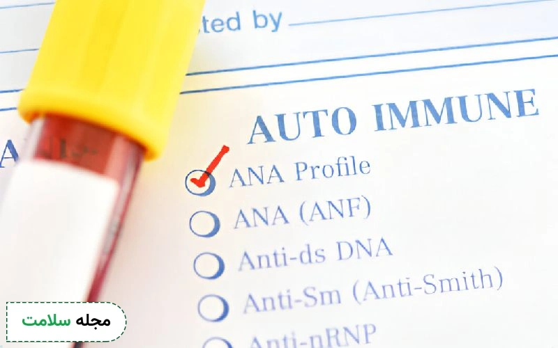 تفسیر ana در آزمایش روماتیسم