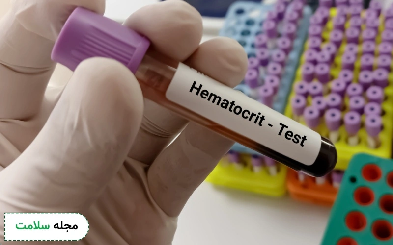 آزمایش هماتوکریت خون چه کاربردی دارد؟ + تفسیر آزمایش Hct