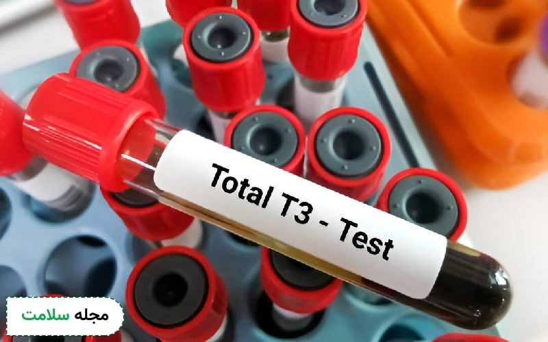 free t3 در آزمایش خون چیست؟