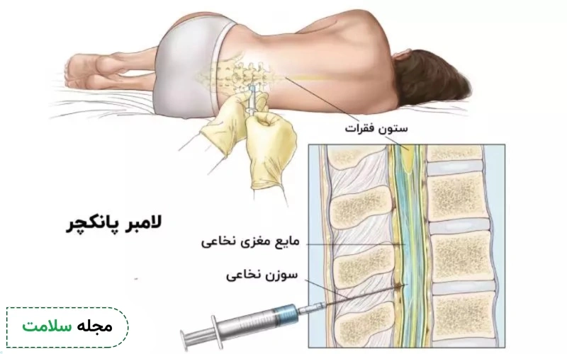 لامبر پانکچر (سوراخ نخاعی) در تست سرطان خون چیست؟