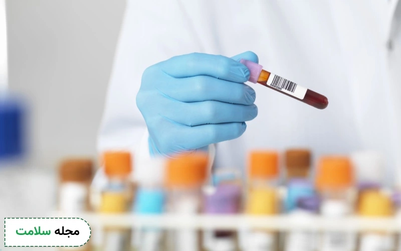 WBC در آزمایش خون چیست؟ تعداد نرمال گلبول سفید (WBC) در آزمایش خون