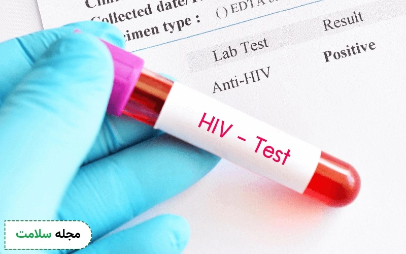 آزمایش ایدز (HIV)؛ راهنمای خواندن برگه آزمایش و تفسیرنتیجه آن