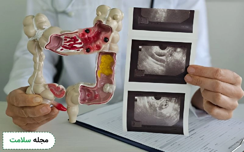 آندوسکوپی چگونه انجام میشود؟ | انواع اندوسکوپی و خطرات آن