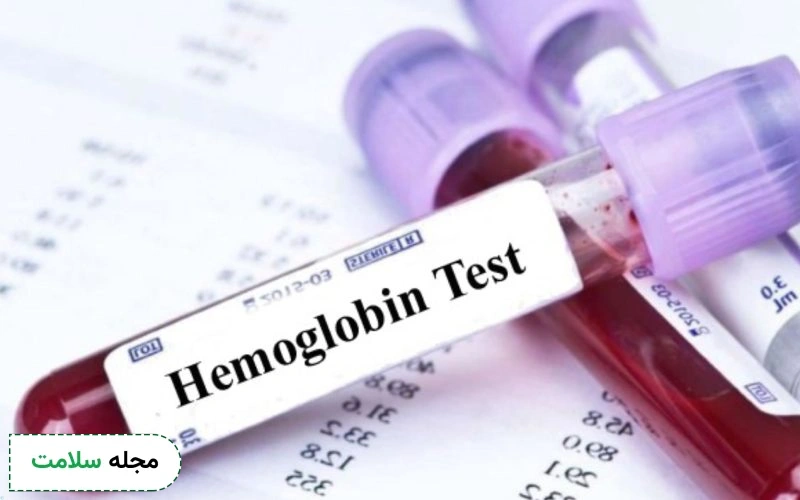 hgb در آزمایش خون چیست؟ پایین یا بالا بودن هموگلوبین (hb) در آزمایش خون