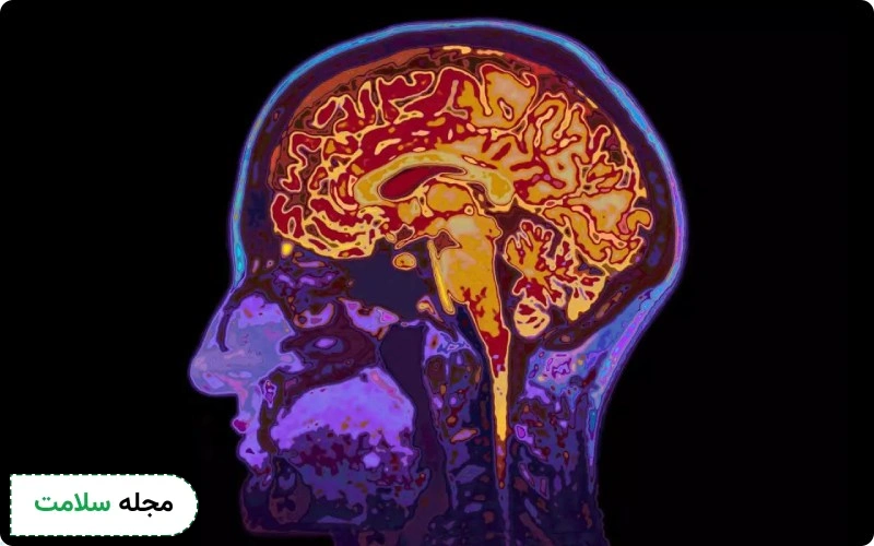 ام ار ای (MRI) چیست و چه کاربردی دارد؟ این روش عارضه ای ندارد