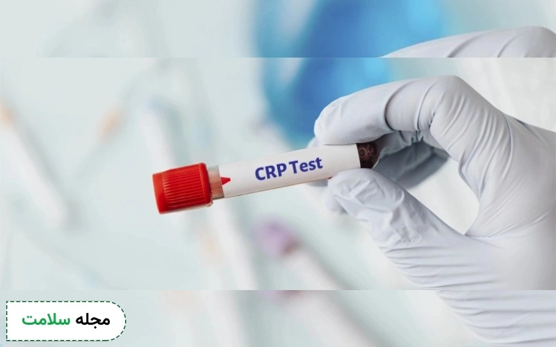 آزمایش crp چیست؟ {تفسیر آزمایش پروتئین c و علت بالا بودن crp}