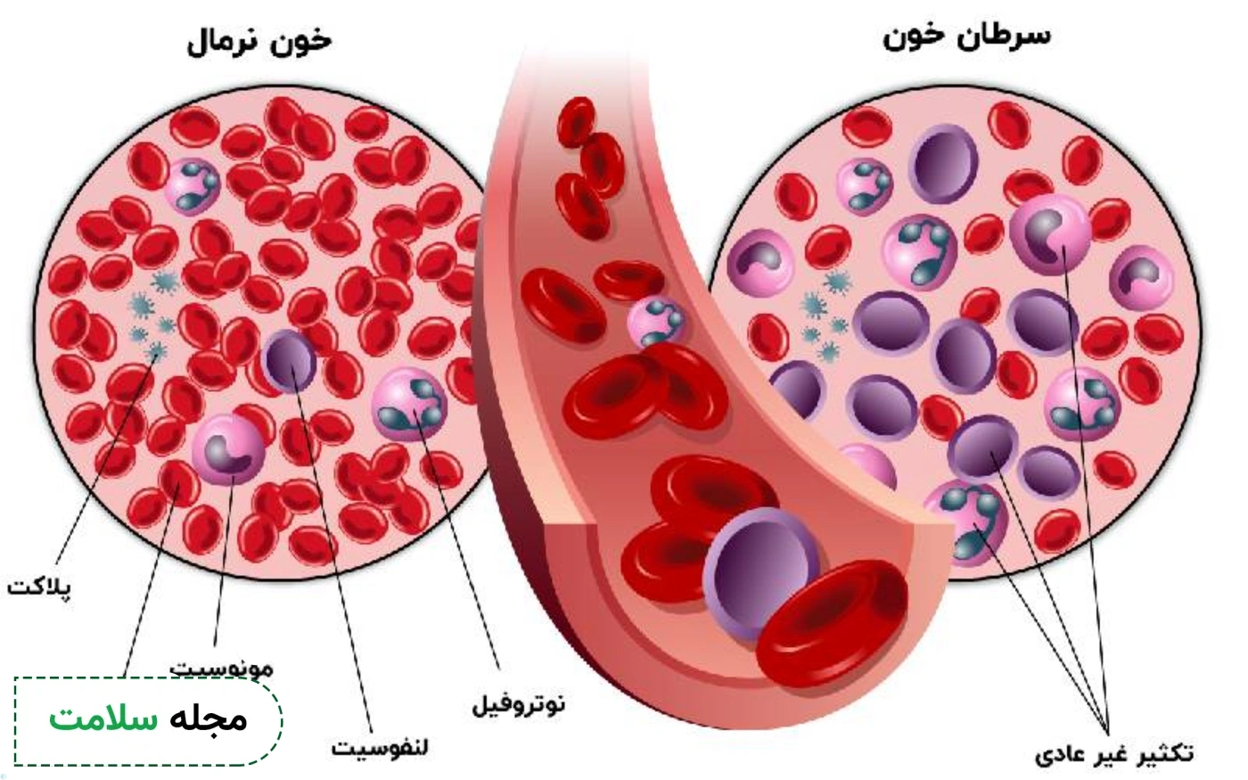 آزمایش سرطان خون شامل چه آزمایش هایی است؟
