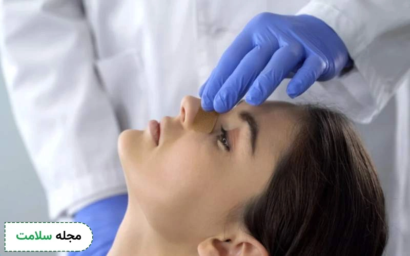کارهای ممنوع در دوره نقاهت عمل بینی کدام است؟