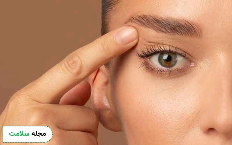 بلفاروپلاستی چشم گربه ای چیست؟
