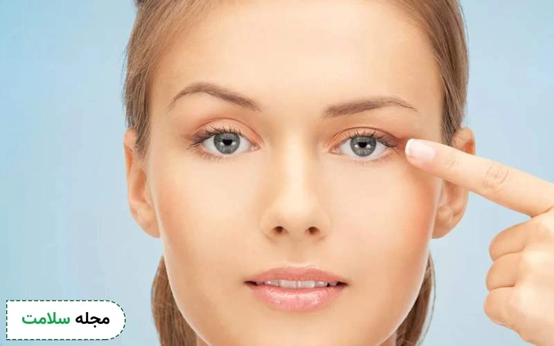 افتادگی پلک بعد از بوتاکس، آیا طبیعی است؟