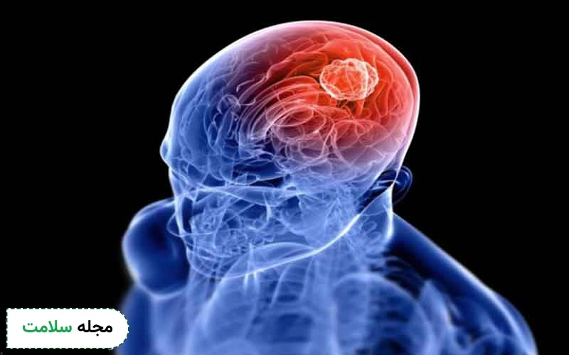 سیستم عصبی چگونه کار می‌ کند؟