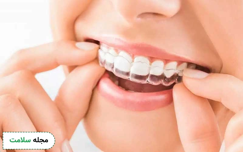نایت گارد چیست و چگونه از آن استفاده کنیم؟