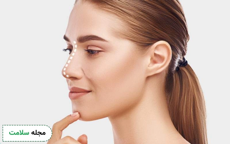 کاربردهای هایفوتراپی بینی چیست؟