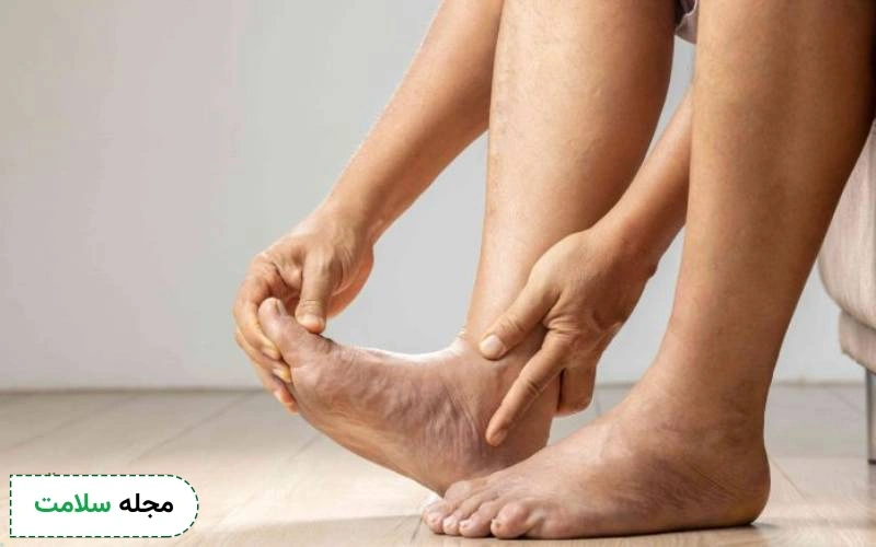 برای ورم پا بعد از زایمان طبیعی و سزارین چه کنیم؟
