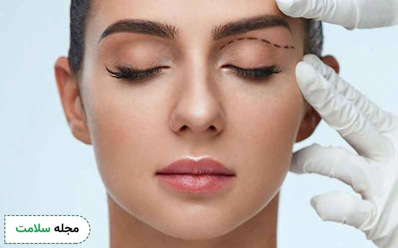 بلفاروپلاستی با لیزر چیست؟