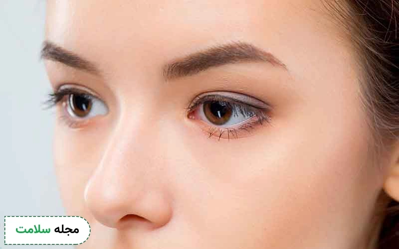 مزایای بلفاروپلاستی پلک پایین چیست؟