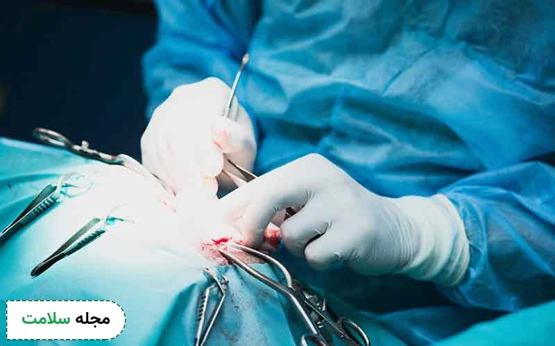 انواع جراحی های مغز و اعصاب چیست؟