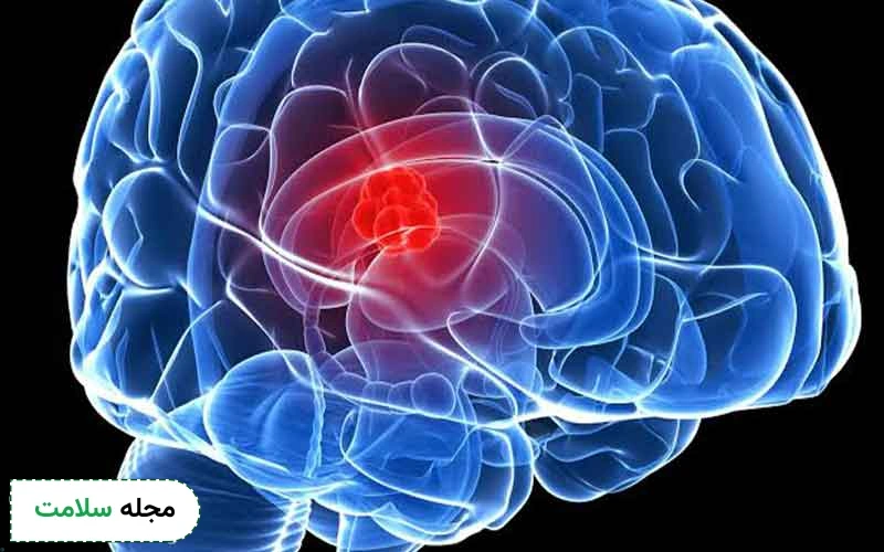 سیستم عصبی چیست و از چه اجزایی تشکیل شده است؟
