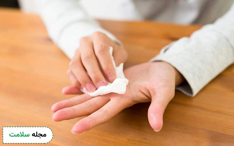 مزایای انجام بوتاکس کف دست چیست؟