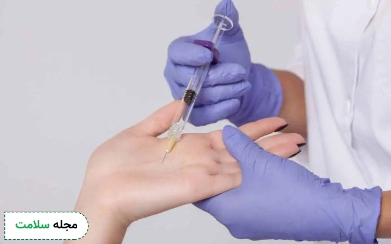بوتاکس کف دست چیست و ماندگاری آن چقدر است؟