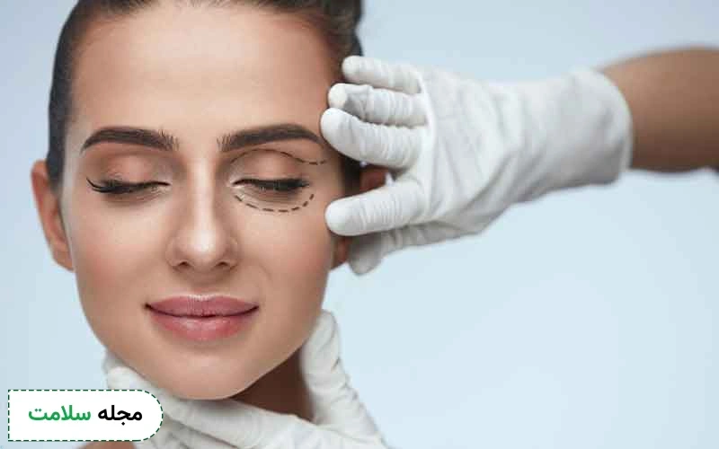 بلفاروپلاستی پلک پایین تا چه اندازه روی تغییر چهره موثر است؟