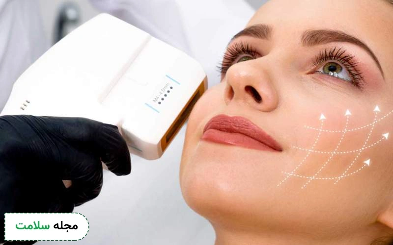 کاربردهای هایفوتراپی صورت چیست؟