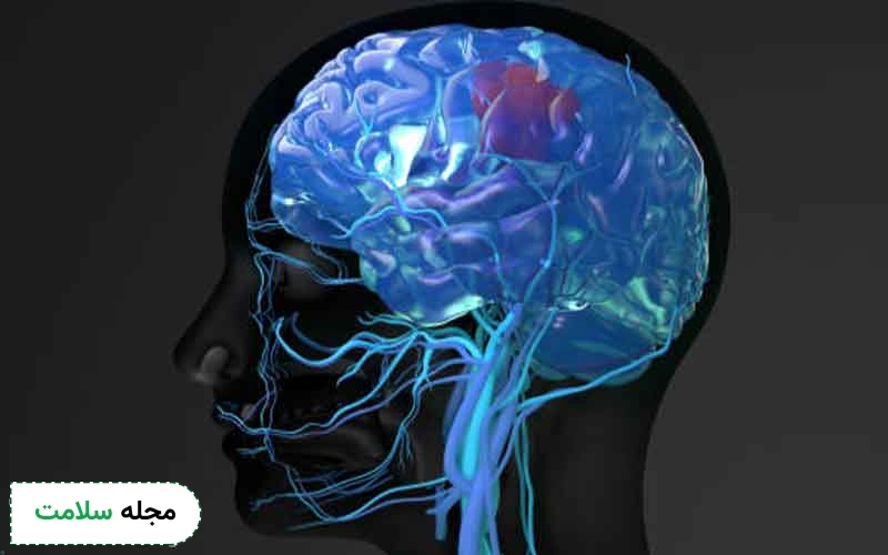 تحریک الکتریکی مغز چگونه انجام می شود؟