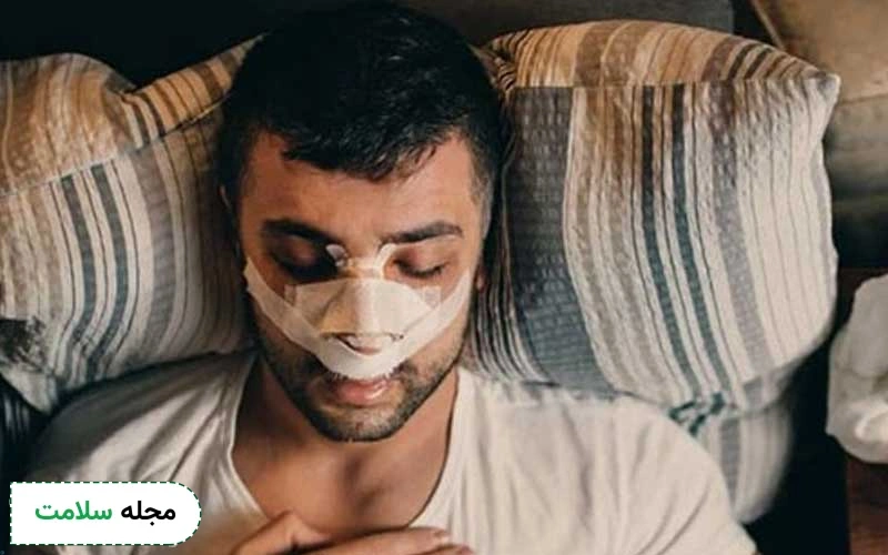 عکس نحوه خوابیدن بعد از عمل بینی چگونه است؟