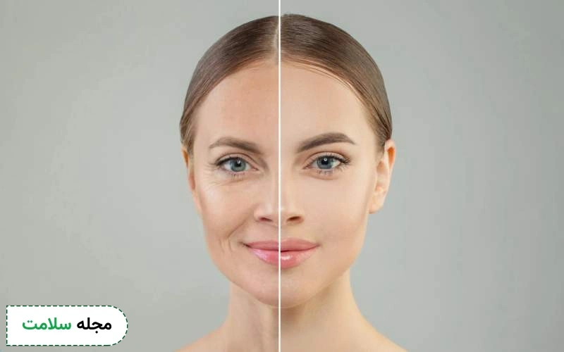 هایفوتراپی صورت چیست؟