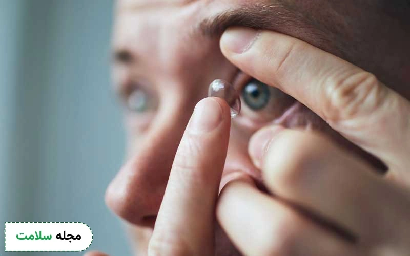 لنز شارژی چیست؟