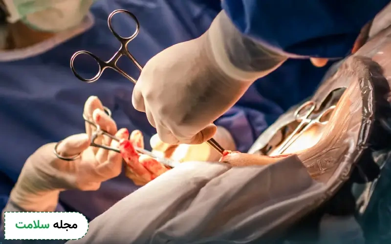 آیا بازکردن لوله رحم بعد از بستن ممکن است؟