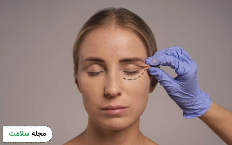 آیا لیفت شقیقه با بوتاکس روش پر عارضه ای است؟