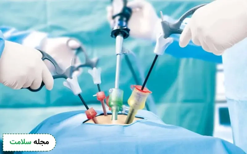 مراقبت های بعد از بازکردن لوله رحم بعد از بستن
