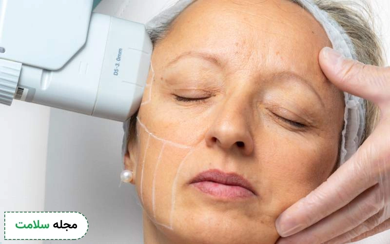 عوارض هایفوتراپی صورت تا چه اندازه خطرناک است؟