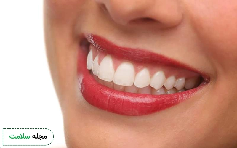 بوتاکس لبخند لثه ای چیست؟