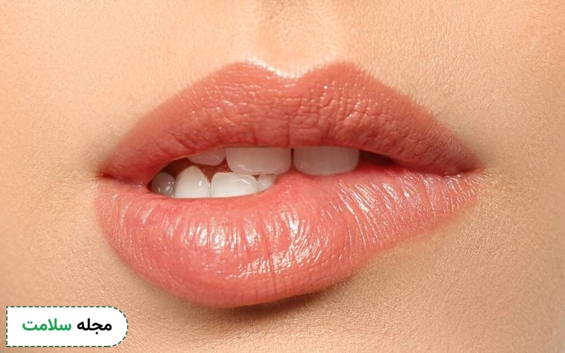آیا ژل لب باید تمدید شود؟