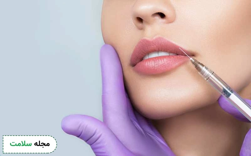 ژل لب برندهای مختلفی دارد.