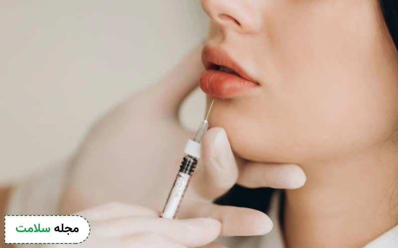 چیکار کنیم ژل لب از بین نره؟