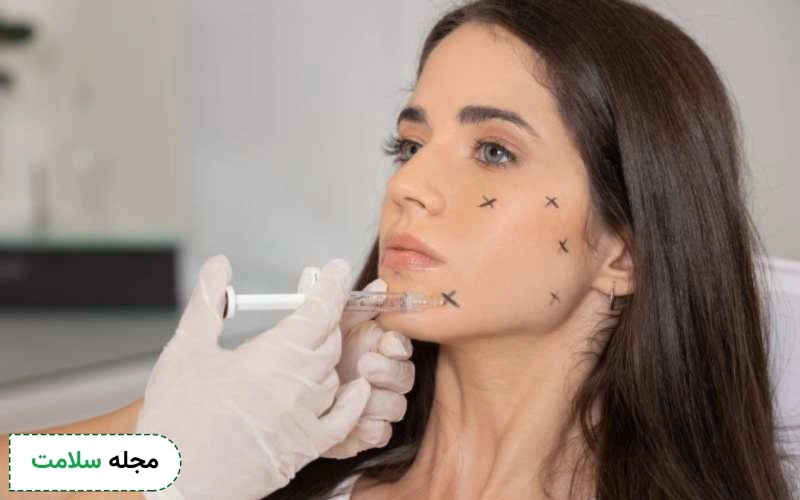 ژل جالپرو در کدام نواحی صورت تزریق میشود؟ مزایا و عوارض این فیلر چیست؟