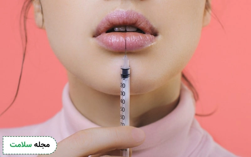 تزریق چربی به لب چگونه انجام میشود؟ ماندگاری آن چقدر است؟