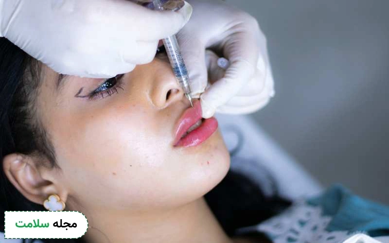 قیمت انواع ژل لب به مدل و برند آن بستگی دارد.