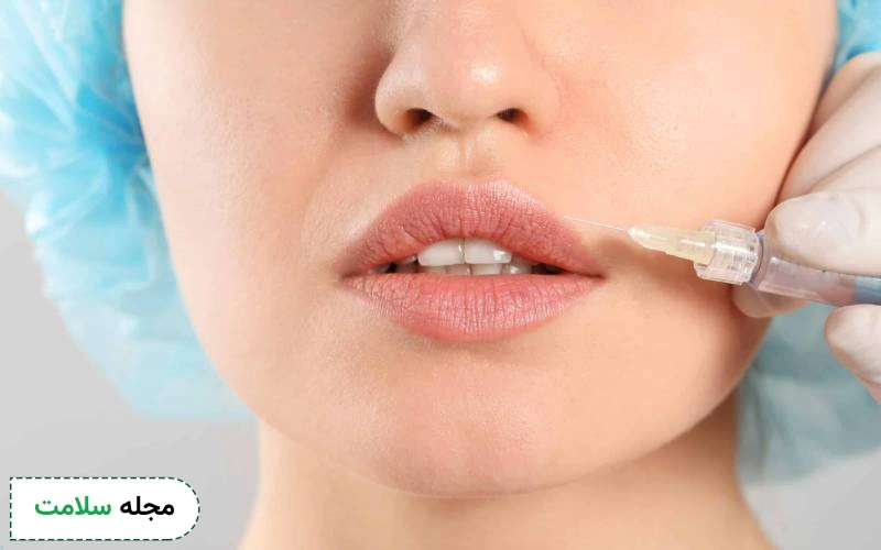 ژل ژوویدرم چه کاربردی دارد؟ این فیلر ساخت کدام کشور است؟