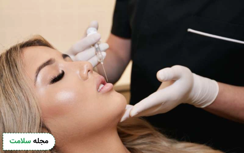 انواع مدل ژل لب را بشناسید. کدام مدل برای شما مناسب است؟