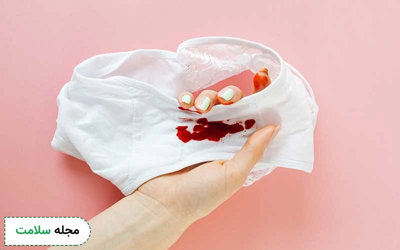 خونریزی بعد از زایمان چه دلیلی دارد؟ آیا لوشیا یک مشکل جدی است؟