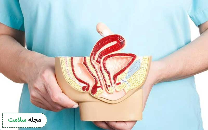 جراحی پرینورافی، مزایا، معایب و مراقبت های بعد از آن