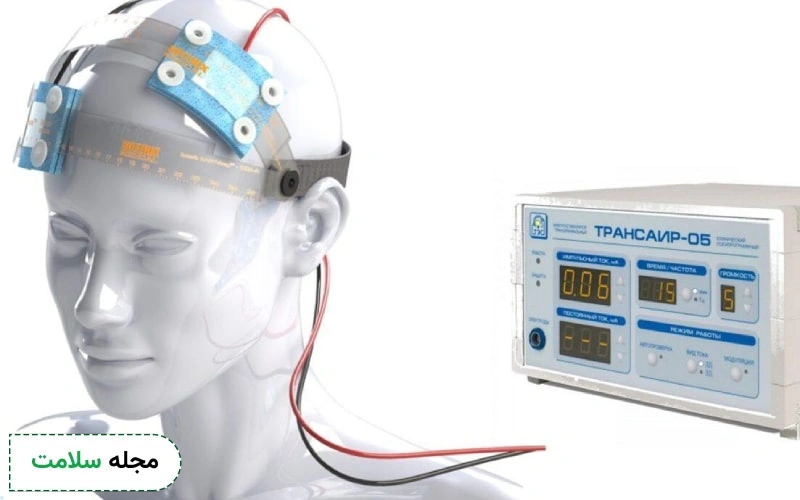 تی دی سی اس (tDCS) یا تحریک الکتریکی مغز چیست؟
