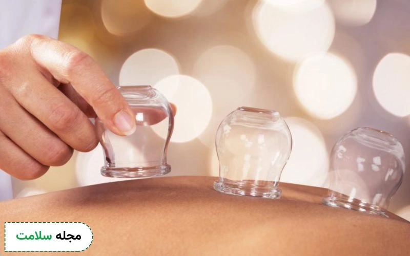 چه افرادی نباید حجامت کنند؟