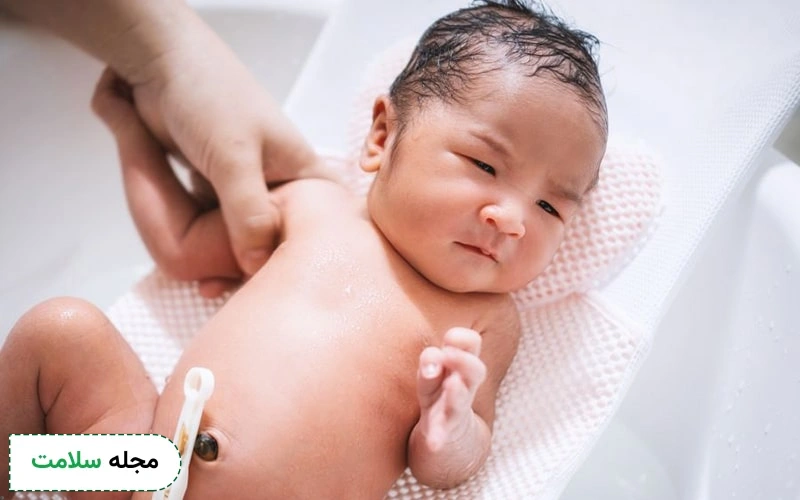 چگونه بند ناف نوزاد را ذخیره کنیم؟
