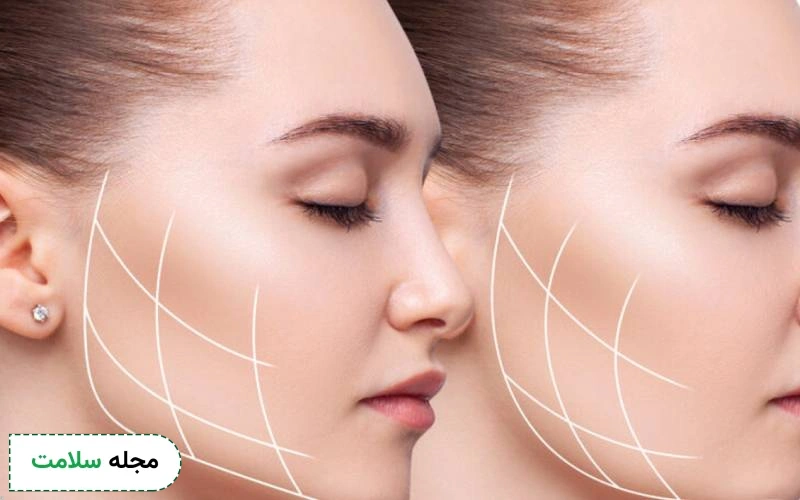 مزایای بوکال فت غبغب چیست؟