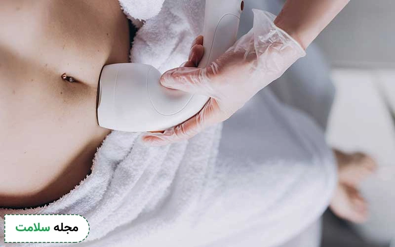 هایفوتراپی شکم چیست؟ مزایا، عوارض و نکات مراقبتی بعد از هایفو شکم و پهلو